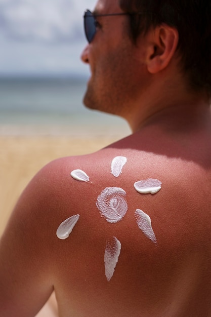 Foto gratuita vista del hombre aplicando loción en la piel quemada por el sol en la playa