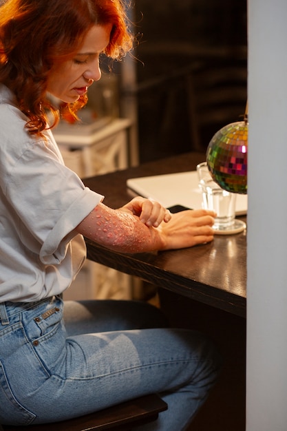 Foto gratuita vista lateral de una mujer con una enfermedad de la piel