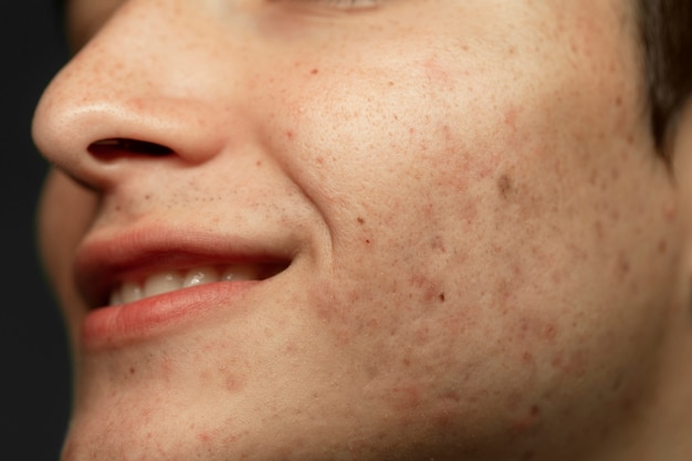 Vista lateral textura de piel de hombre sonriente