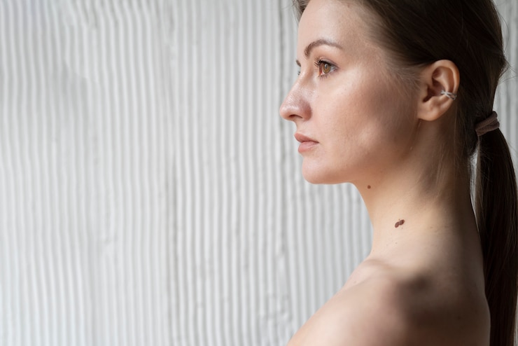 Photo Gratis wanita dengan melanoma pada kulitnya