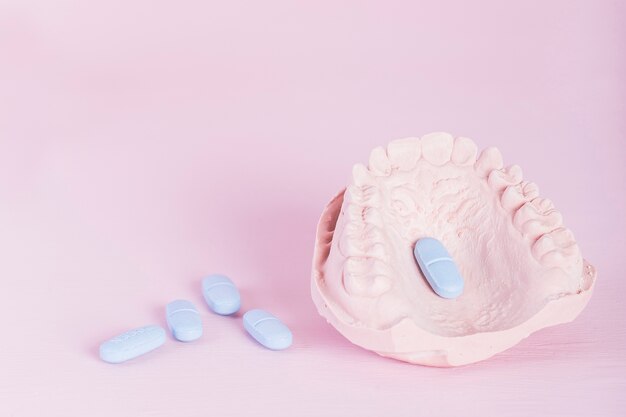 Yeso modelo dental y píldoras sobre fondo rosa