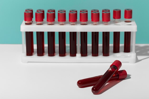 Assortimento di campioni di sangue di coronavirus in laboratorio
