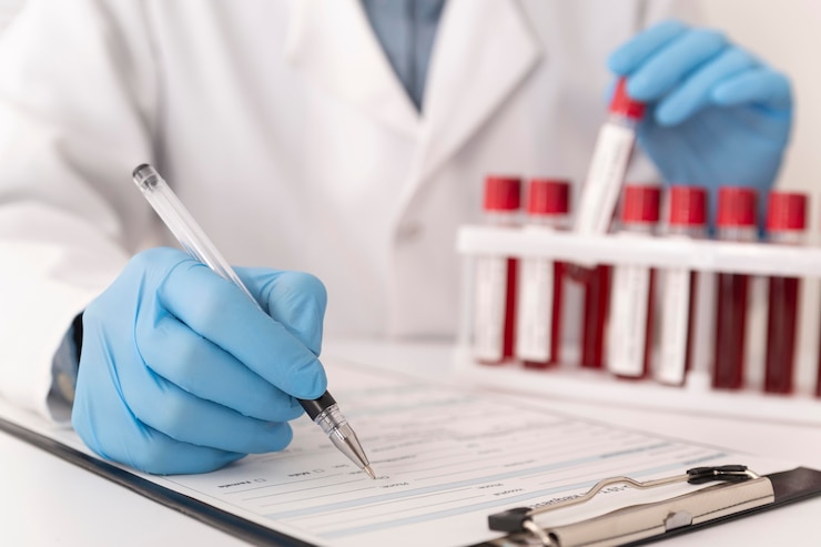 Foto gratuito assortimento di campioni di sangue di coronavirus in laboratorio