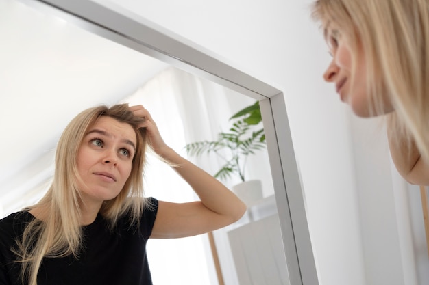 Chiuda sulla donna con la forfora che si guarda allo specchio