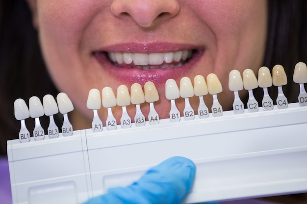 Dentista che esamina paziente femminile con le tonalità dei denti
