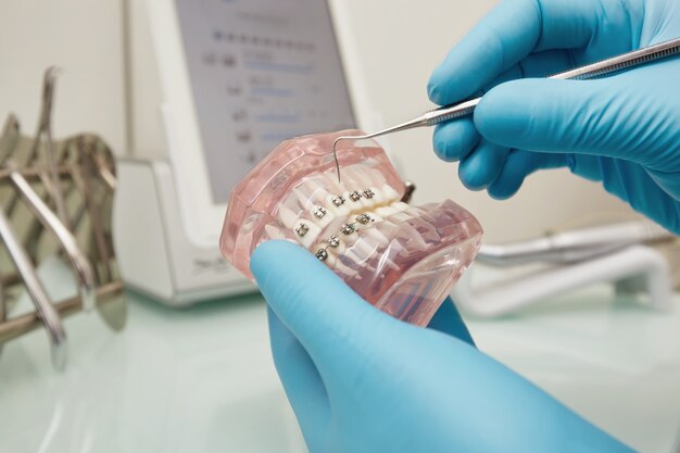 Dentista che tiene il modello di plastica dentale con le parentesi graffe