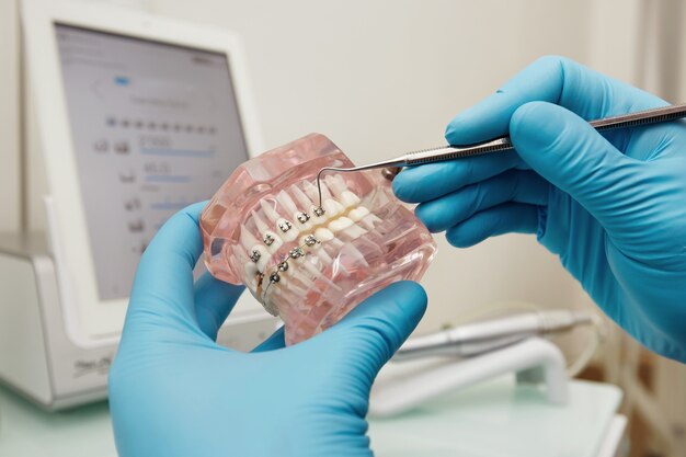 Dentista che tiene il modello di plastica dentale con le parentesi graffe