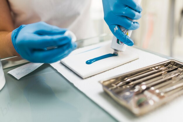 Dentista maschio che utilizza materiale per impronte in silicone blu