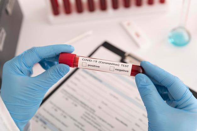 Disposizione dei campioni di sangue del coronavirus in laboratorio