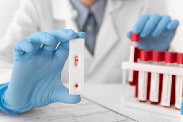 Disposizione dei campioni di sangue del coronavirus in laboratorio