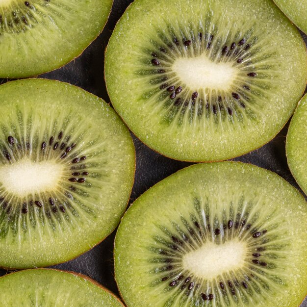 Disposizione deliziosa del kiwi sopra la vista