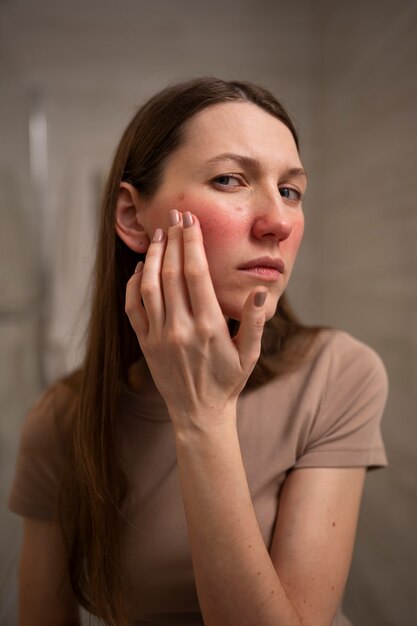 Donna che si occupa della condizione della pelle rosacea sul viso