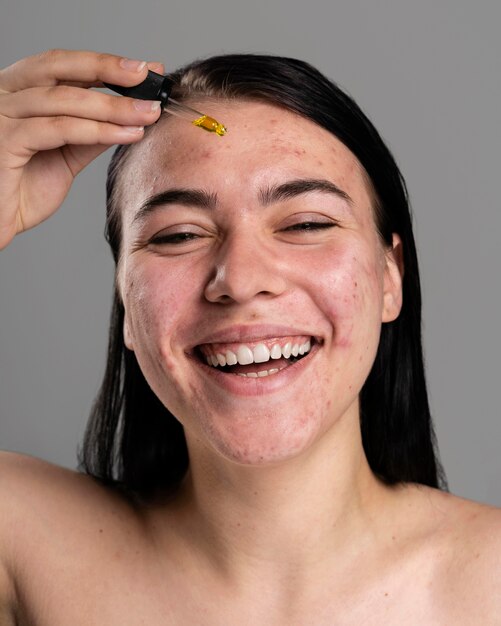 Donna che utilizza un olio speciale per l'acne