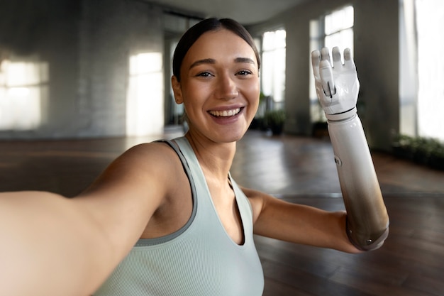 Donna sorridente del colpo medio con il braccio protesico