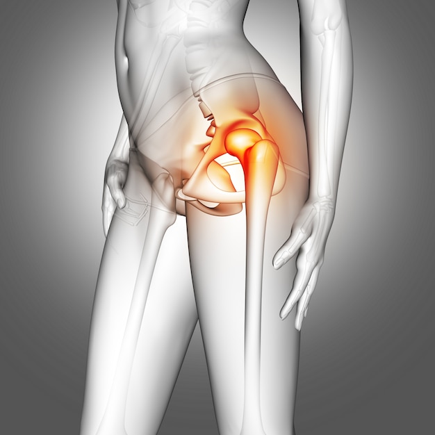 Figura medica femminile 3D con osso dell&#39;anca evidenziata