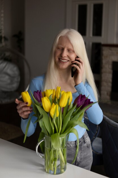 Giovane donna con albinismo e fiori di tulipano