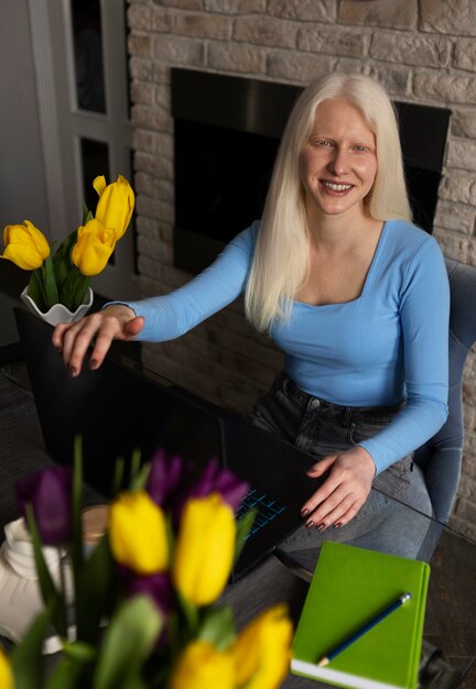 Giovane donna con albinismo e fiori di tulipano
