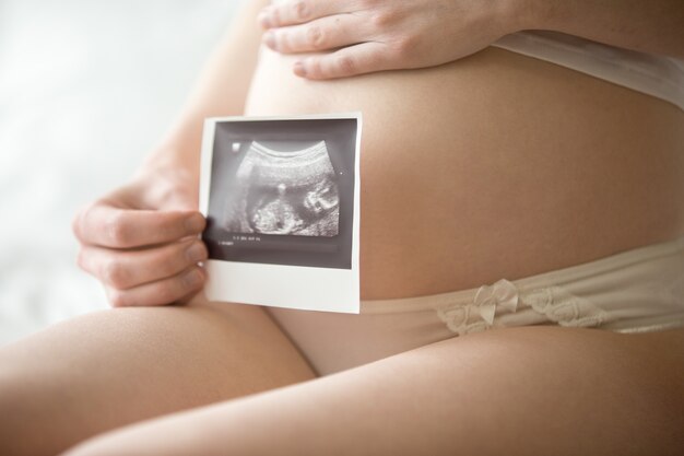 Giovane donna incinta che mostra l'immagine ultrasonica del suo bambino