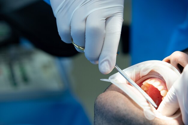 Il dentista con lo strumento esegue alcune manipolazioni nella bocca del paziente