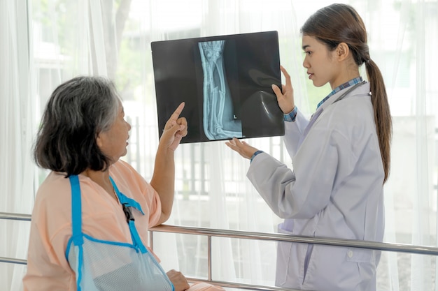 Il dottor Inform informa i risultati dell'esame di raggi X per incoraggiare una donna anziana anziana Pazienti con braccio rotto in ospedale