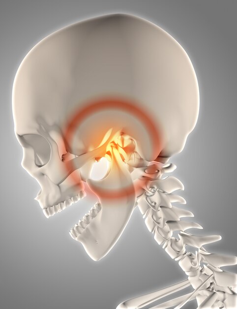 Il rendering 3D di uno scheletro con mandibola evidenziato per mostrare il dolore