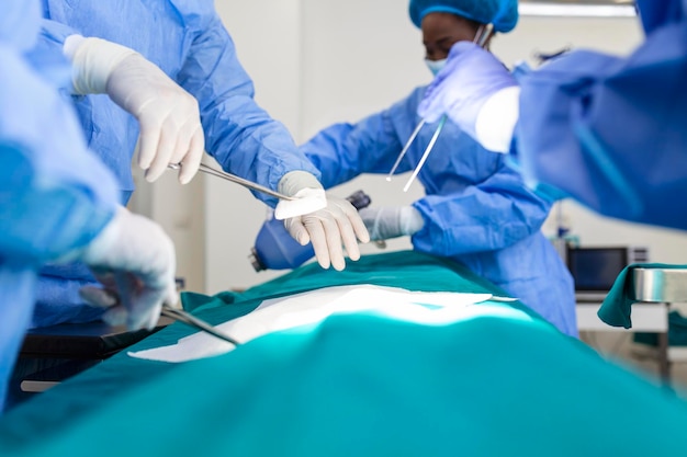 Il team di chirurghi in uniforme esegue un'operazione su un paziente in una clinica di cardiochirurgia Medicina moderna un team di professionisti della salute dei chirurghi