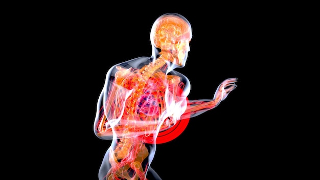 Illustrazione 3D astratta di un attacco di cuore