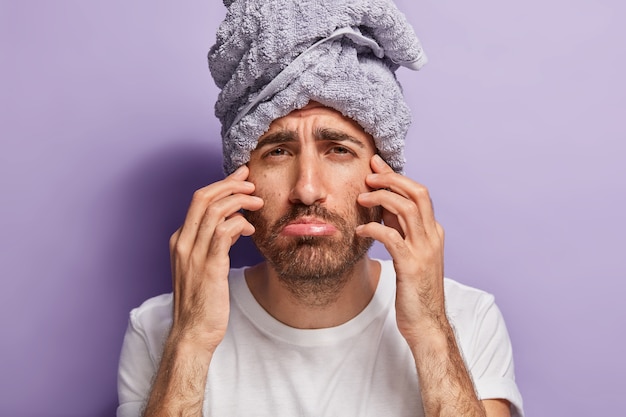 Immagine ravvicinata di uomo insoddisfatto tocca il viso, ha cattivi sentimenti dopo le procedure termali, indossa un asciugamano sulla testa