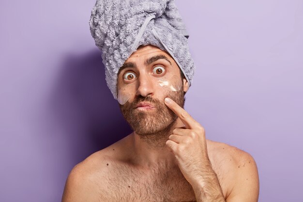 L'uomo sorpreso nota l'acne sul viso, si preoccupa del bell'aspetto, applica cuscinetti antietà sotto gli occhi