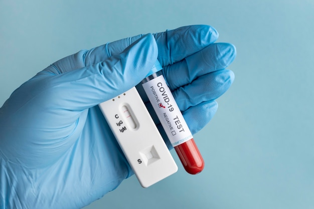 Mano con guanti protettivi in possesso di un campione di sangue per il test covid