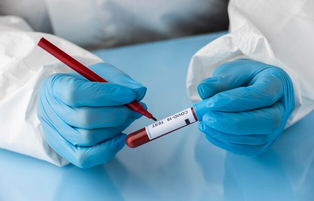 Mano con guanti protettivi in possesso di un campione di sangue per il test covid