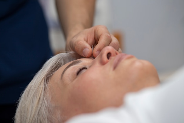 Medicina tradizionale giapponese con vista laterale dell'ago