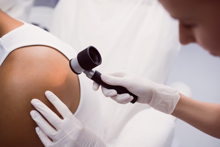 Foto gratuito medico che rimuove talpa con trattamento laser