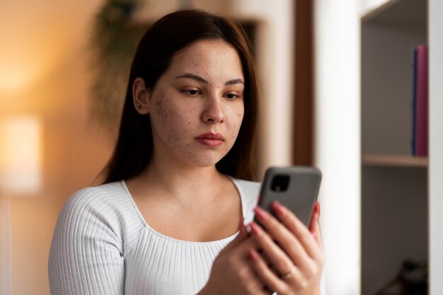 Persona che ha a che fare con la rosacea
