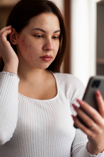 Persona che si occupa di rosacea