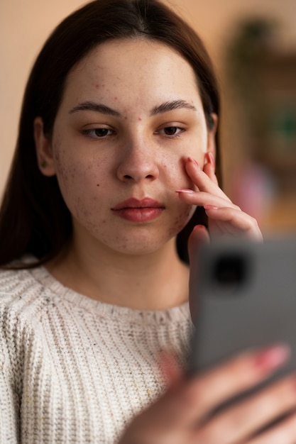 Persona che si occupa di rosacea