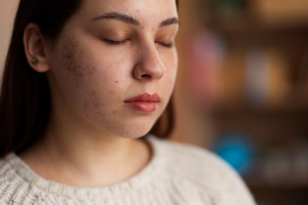 Persona che si occupa di rosacea