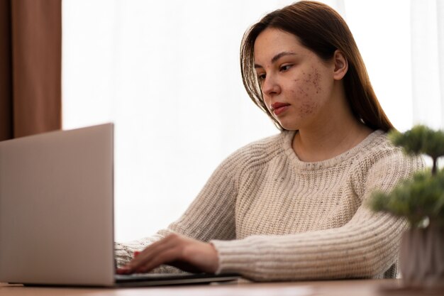 Persona che si occupa di rosacea