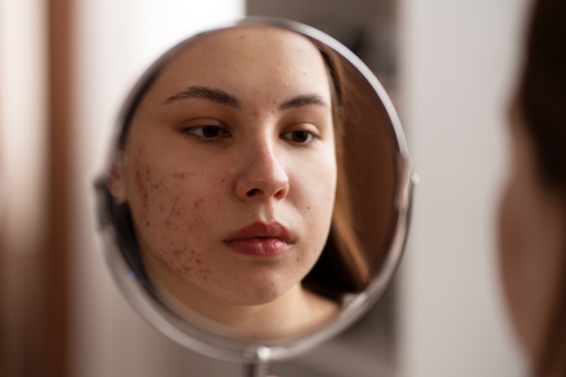 Persona che si occupa di rosacea