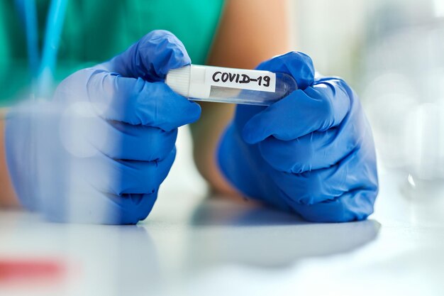 Primo piano del tecnico di laboratorio che tiene la provetta del coronavirus