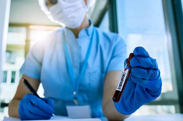 Primo piano dell'epidemiologo che analizza un campione di sangue infetto da coronavirus in clinica