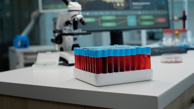 Primo piano di vacutainer con sangue o liquido rosso in laboratorio