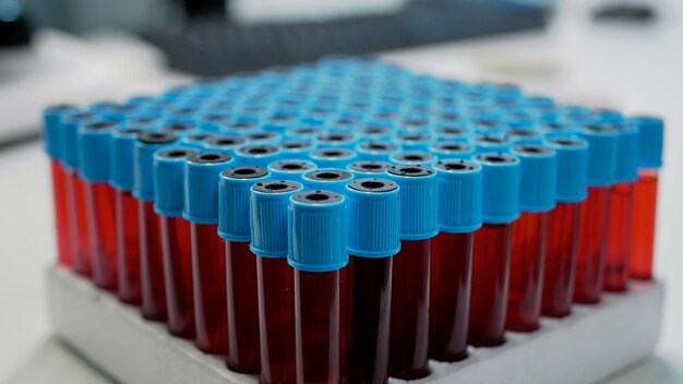 Primo piano di vacutainer medici con sangue sul vassoio