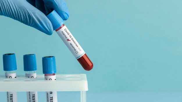 Primo piano sull'analisi del sangue per omicron