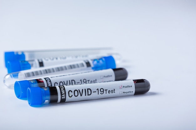 Provetta con campione di sangue per test COVID-19