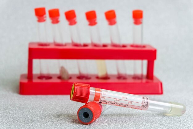 Provette per vacutainer medicali con segno rosso con campioni biologici e supporto portalaboratorio