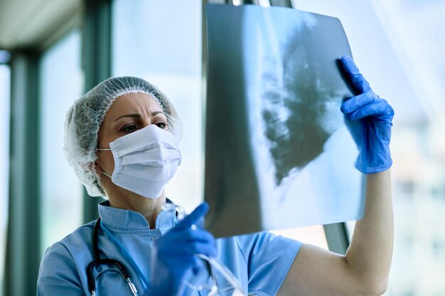 Radiologo femminile che analizza i raggi X del torace di un paziente in clinica medica durante l'epidemia di coronavirus