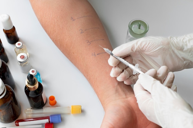 Test di reazione allergica cutanea sul braccio di una persona