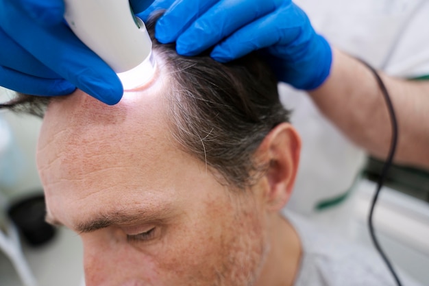 Uomo che si sottopone a un trattamento per la caduta dei capelli