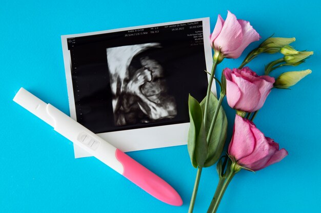 Vista dall'alto test di gravidanza positivo e fiori